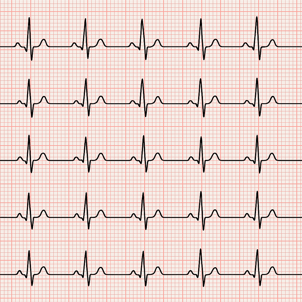 Pemeriksaan Jantung/ECG