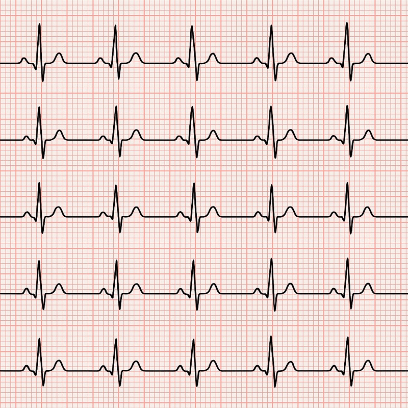 Pemeriksaan Jantung/ECG